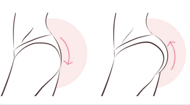 Body Sculpting Treatments