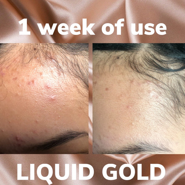 Liquid Gold Hydrate + Heal Roller
